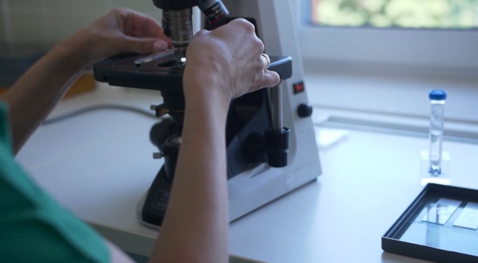 240 Tuberculosis Cases Detected in 2025 – What Is the Current Situation in Albania