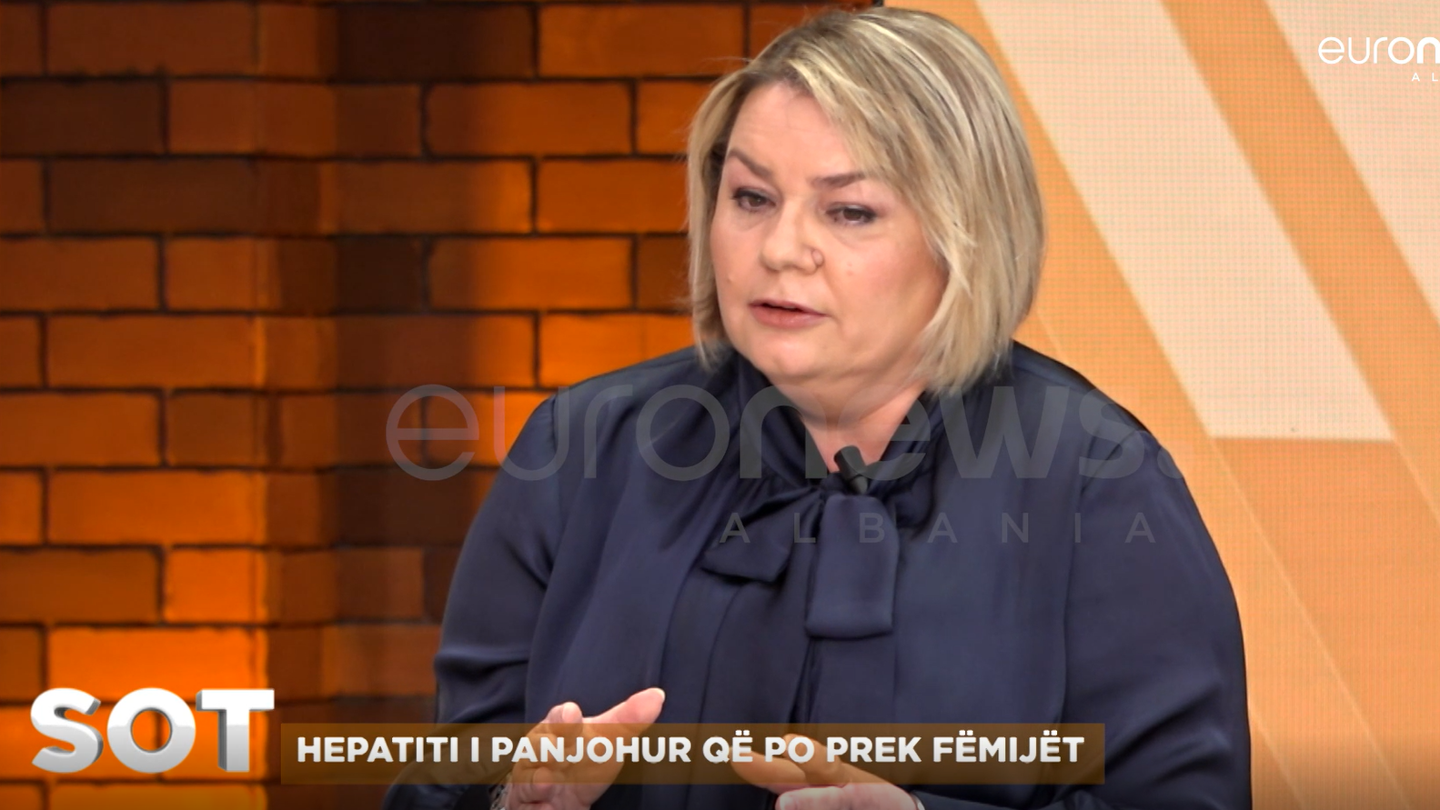 ‘Shenjat e hepatitit të ngjashme me gripin’, mjekja: Kur duhet të kemi kujdes