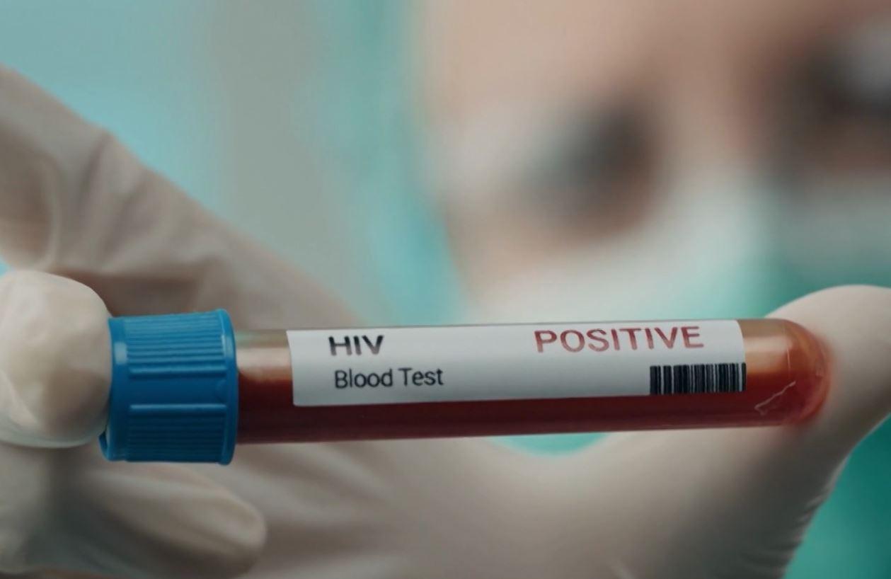 Rriten rastet me HIV-AIDS, ISHP: Në një muaj, 3 femra dhe 5 meshkuj të infektuar