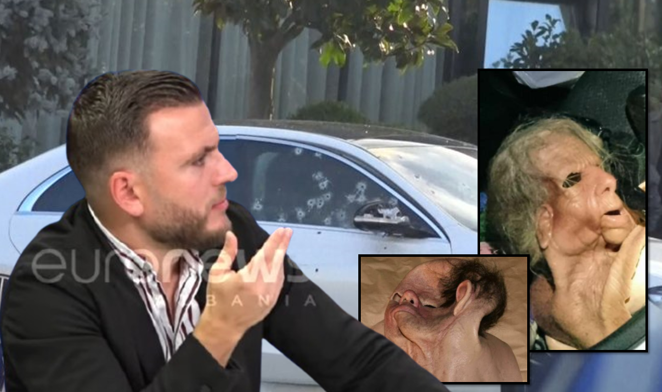  Mund të jenë përdorur maska plastike   gazetari  Atentatorit iu bllokua arma por 