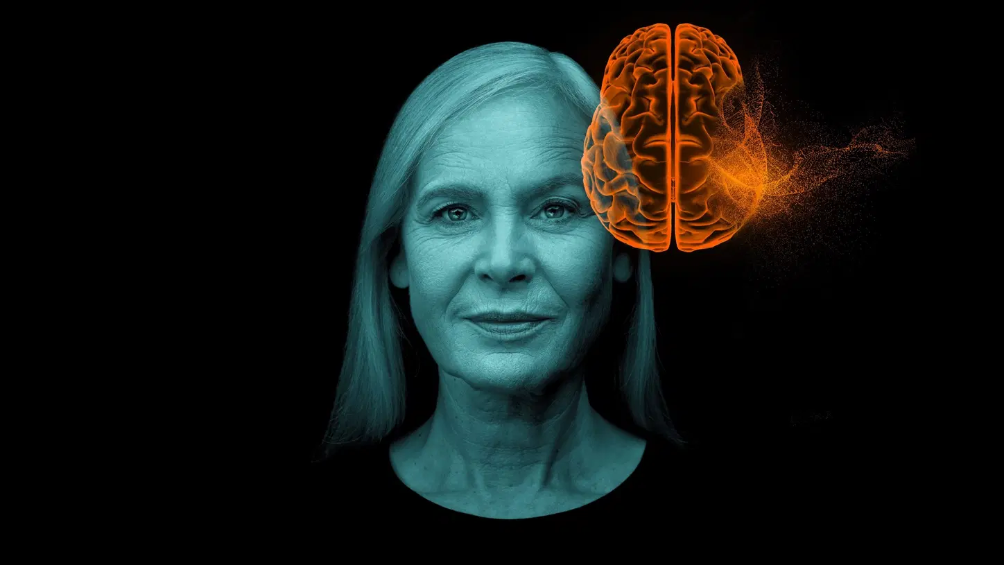 Zbulim premtues  një ilaç i ri mund të ndalojë Alzheimerin para shfaqjes së simptomave