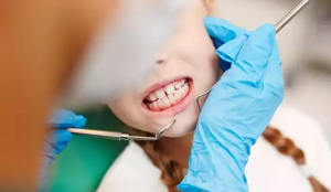 Rritet numri i vizitave dentare në verë, specialistët: Mos i neglizhoni dhëmbët e qumështit