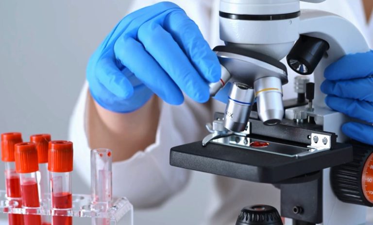 Analiza e re e gjakut shkurton kohën e zbulimit të endometriozës