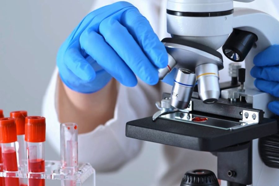 Analiza e re e gjakut shkurton kohën e zbulimit të endometriozës